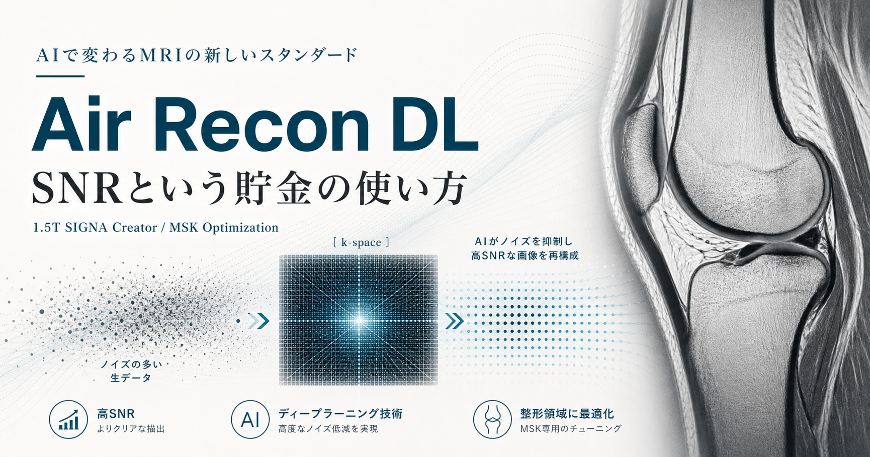 Air Recon DLは時間短縮技術ではない