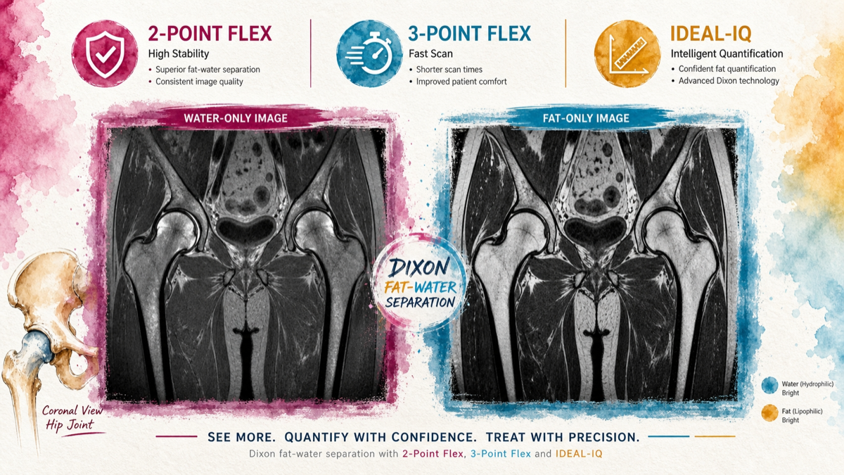 GE MRI Flex基礎 ── FSE Flex / CUBE Flex の使い方と1-TR/2-TRの選び方