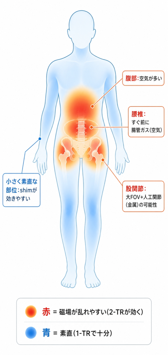 部位別・磁場の乱れやすさ