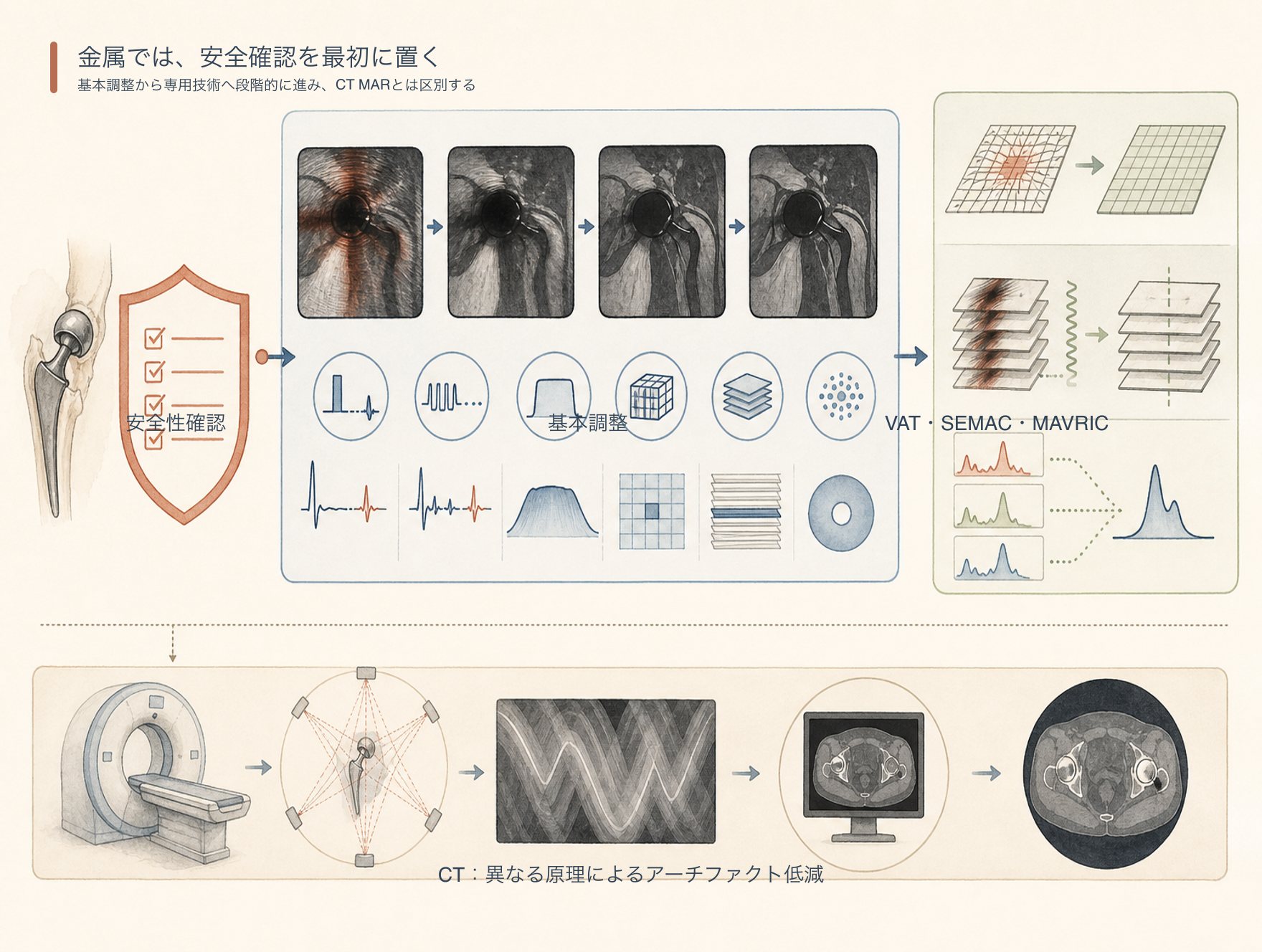 MRI金属アーチファクト対策の優先順位