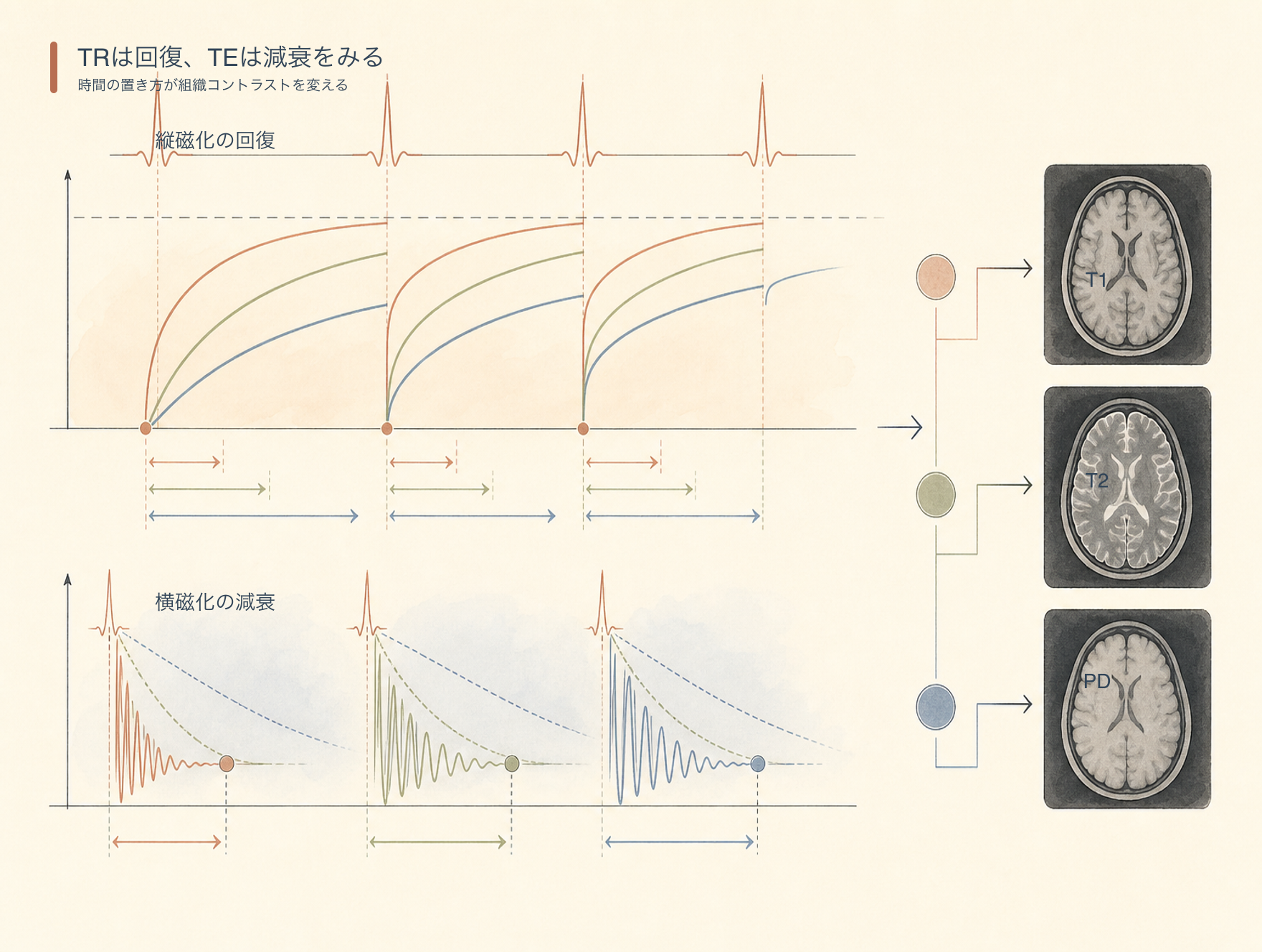TRによる縦磁化回復とTEによる横磁化減衰