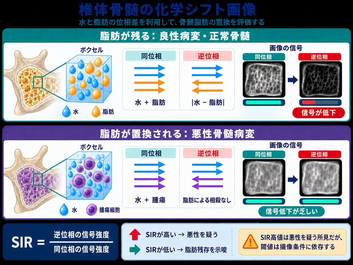 椎体骨髄のchemical shift imagingを説明する模式図