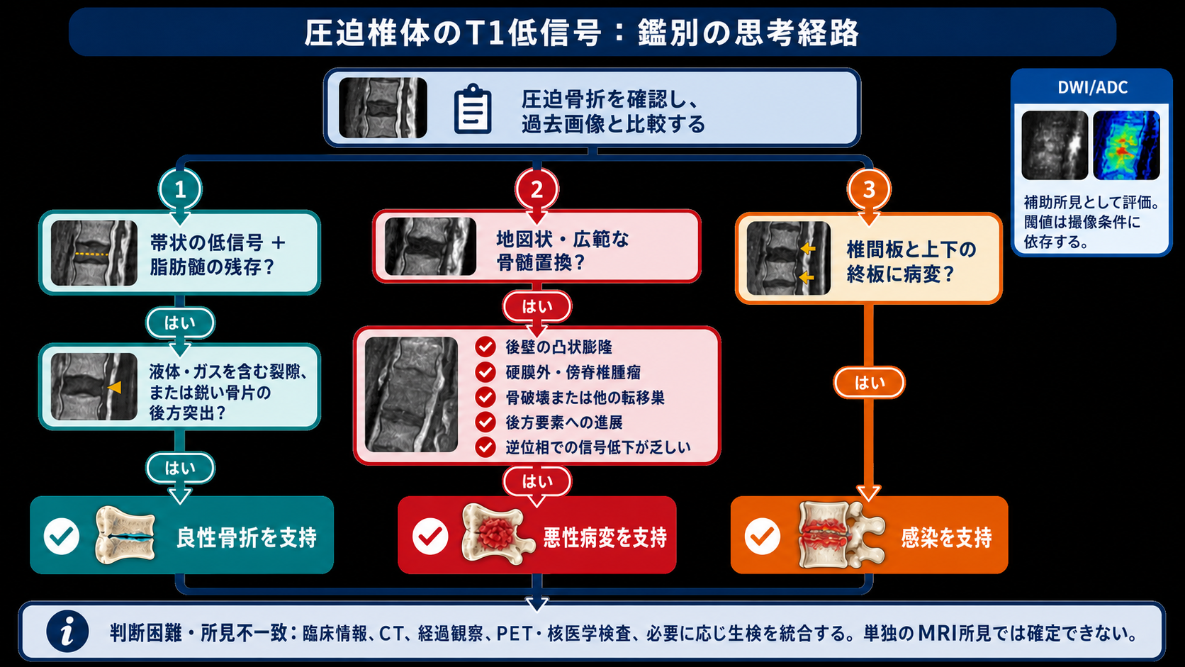 圧迫椎体のT1低信号を評価する意思決定ツリー