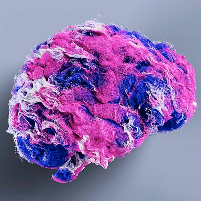 Air Recon DL — MSK領域完全解説